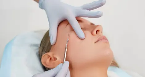 Australian Skin Clinics MacArthur CBD Brisbane
