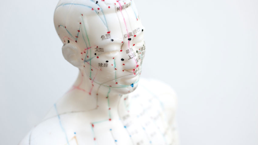 Acupuncture+Man1