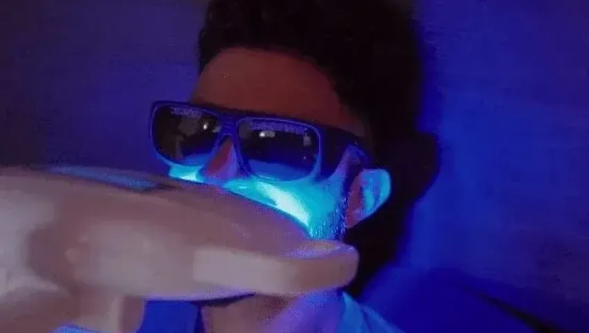 Imgi 11 Teeth Whitening.Jpg