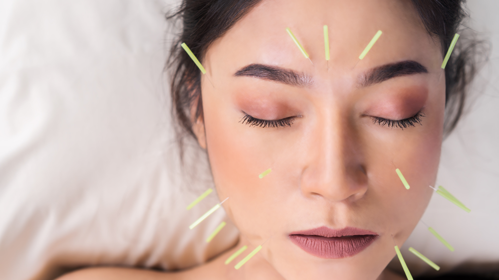 Face acupuncture