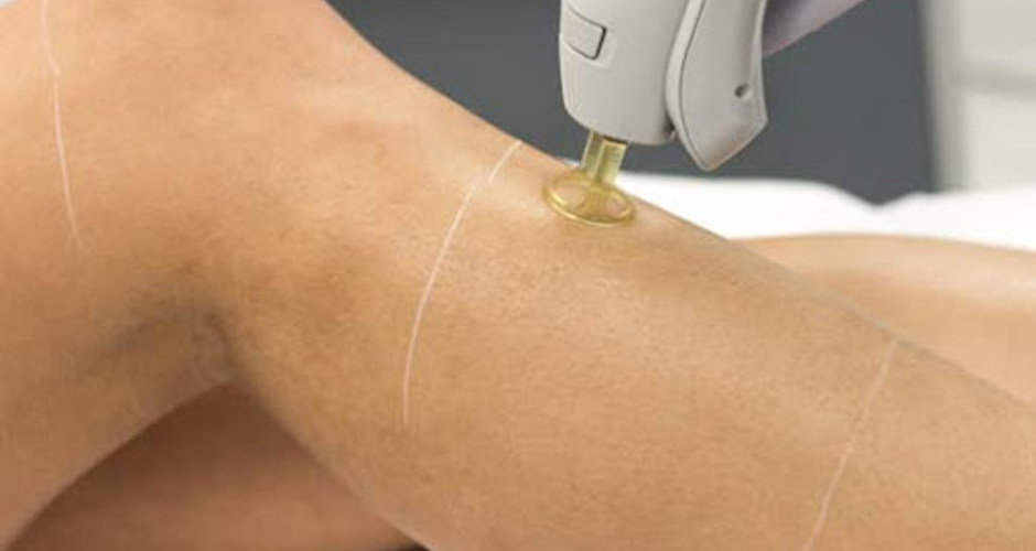 Australian Skin Clinics Carindale - 1